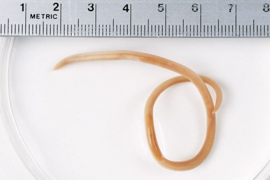 Ascaris is een rondworm die in het menselijk lichaam leeft